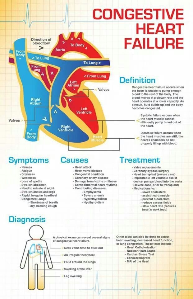 Congestive Heart Failure Symptoms Causes And Treatment