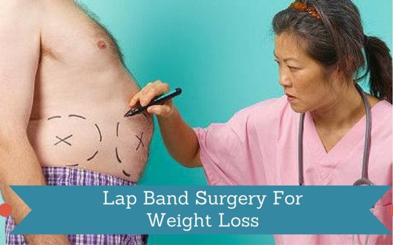 Lap Band Surgery Gastric Banding , A Weight Loss Surgery