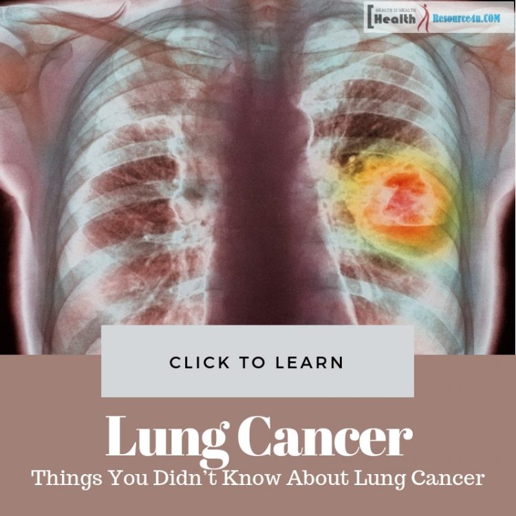 Important Facts About Lung Cancer You Should Know