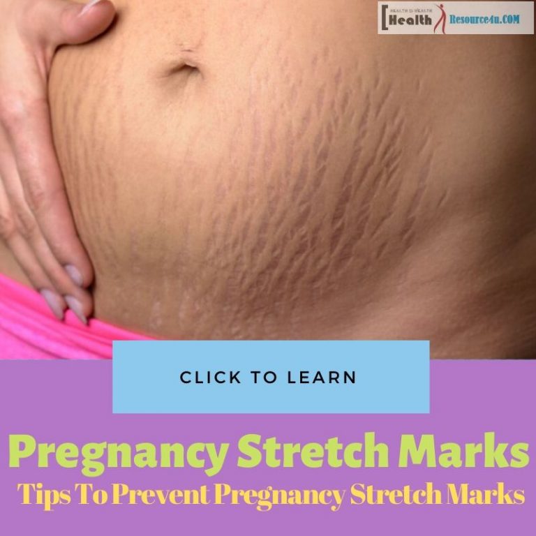 Pregnancy Stretch Marks