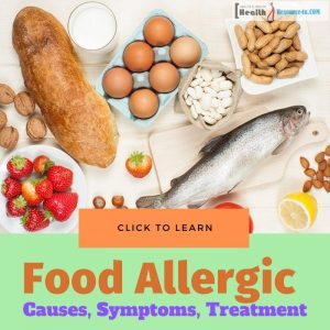 Food Allergic Problem - Causes, Symptoms And Its Treatment