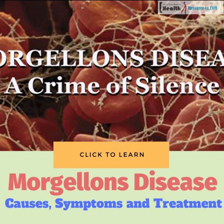 Morgellons Disease - Causes, Picture, Symptoms And Treatment