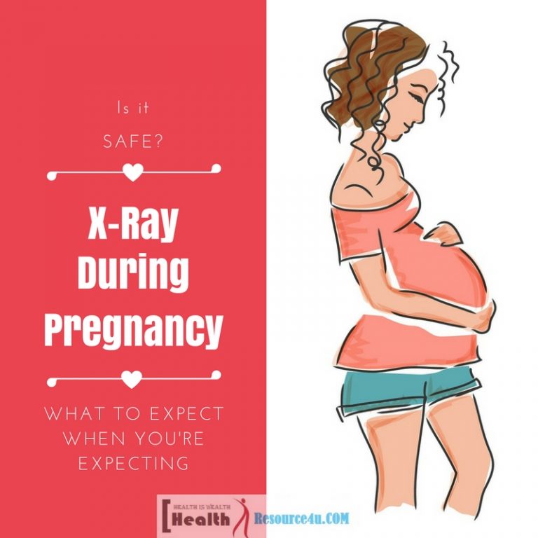 X Rays During Pregnancy