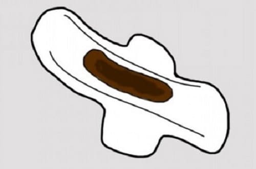 Causes Of Brown Discharge Instead Of Your Period Ways To Get Rid Of It