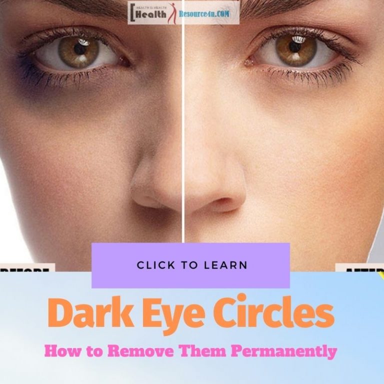 dark eye circle removal