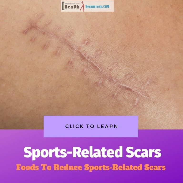 Sports-Related Scars