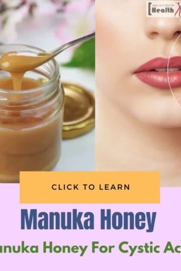 Manuka Honey for Relief in Cystic Acne